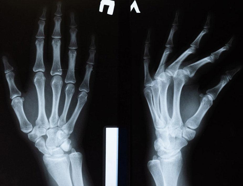 Glucosamine & Chondroitin Supplements