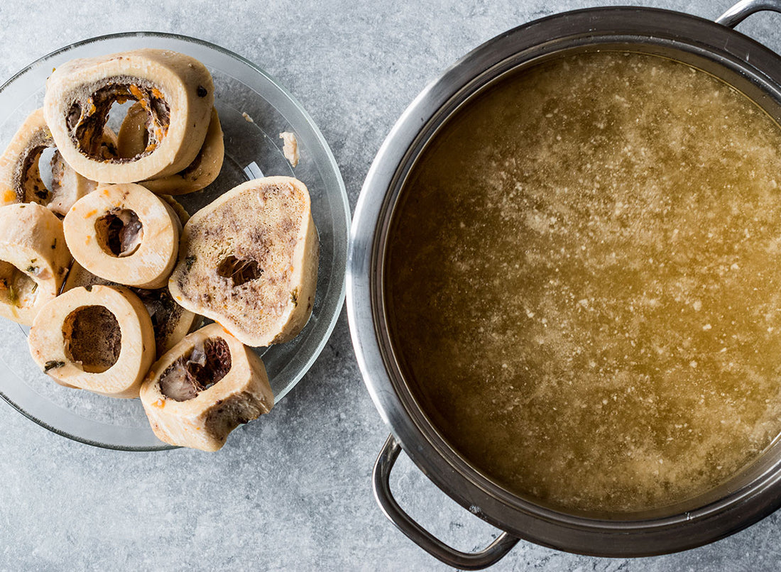 What is the best bone broth supplement