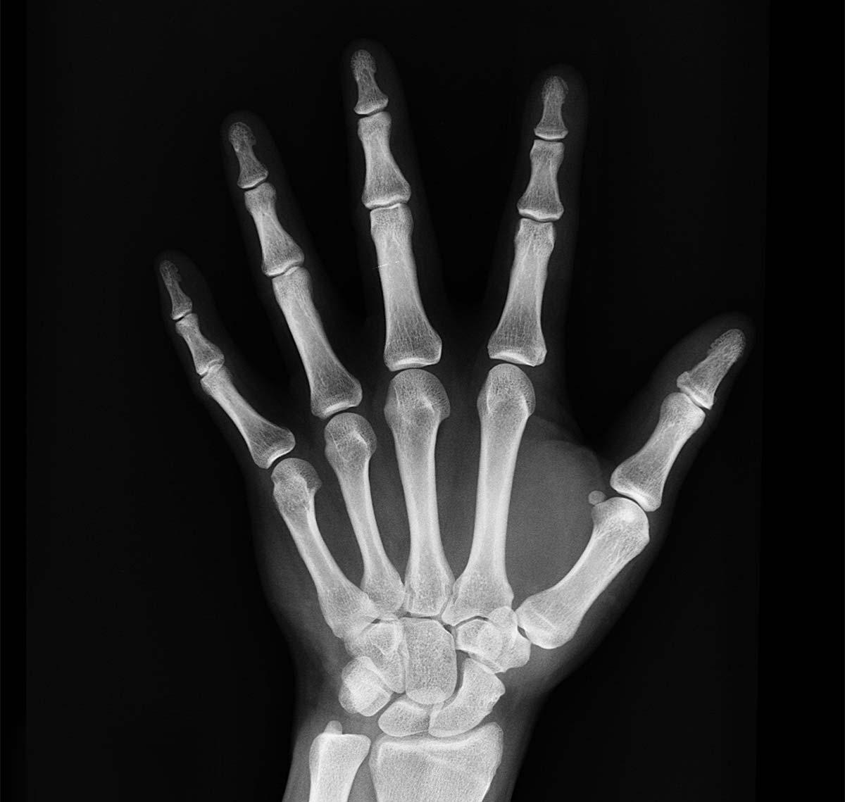 Bone & Joint Support Supplements